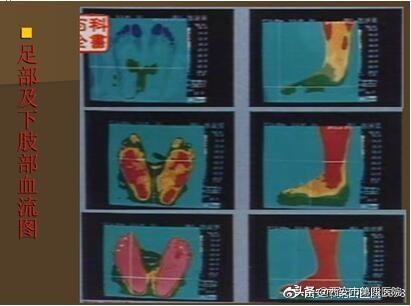 足部反射区反射区按摩疗法隶属于无损伤医学之精华的部位「人体发生疾患时」  第10张